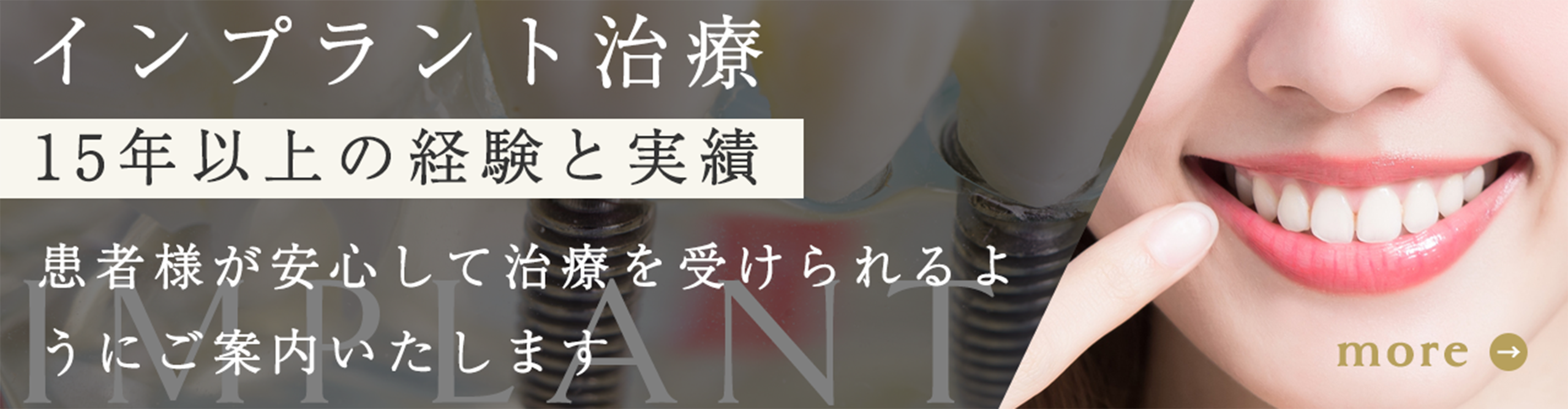 インプラント治療 15年以上の経験と実績