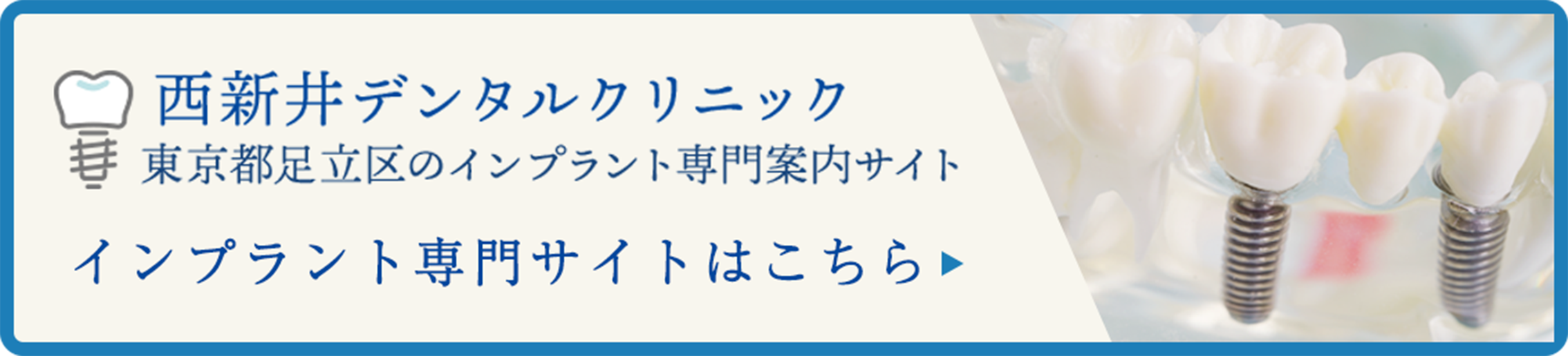 インプラント専門サイト