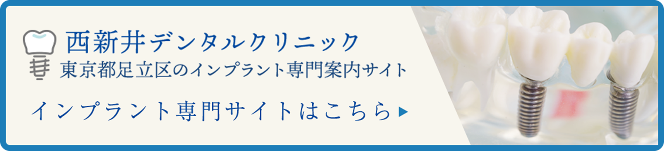 インプラント専門サイト